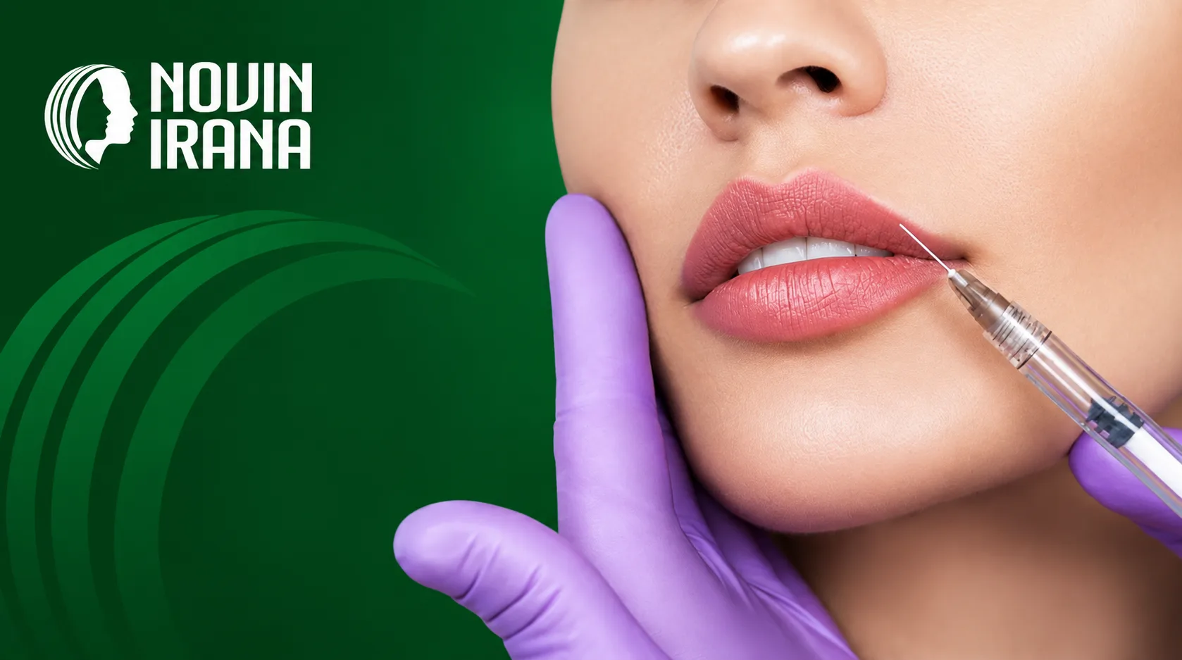 انواع مدل های تزریق ژل لب در مشهد